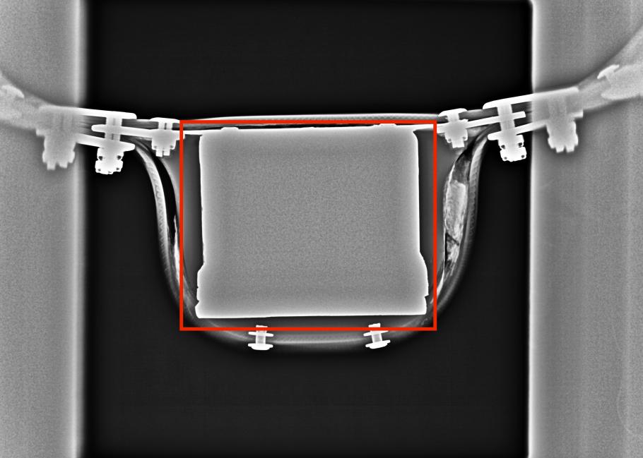 An X-radiograph of a collar.