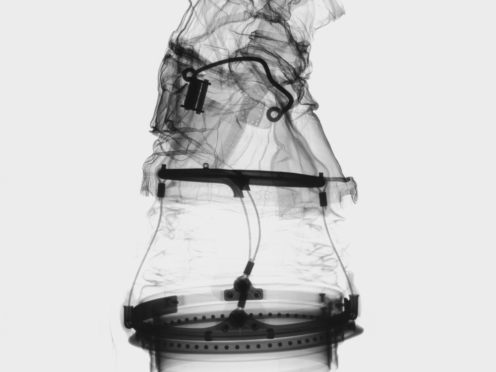 X-ray scan of a lunar glove belonging to the spacesuit used by Harrison "Jack" Schmitt.