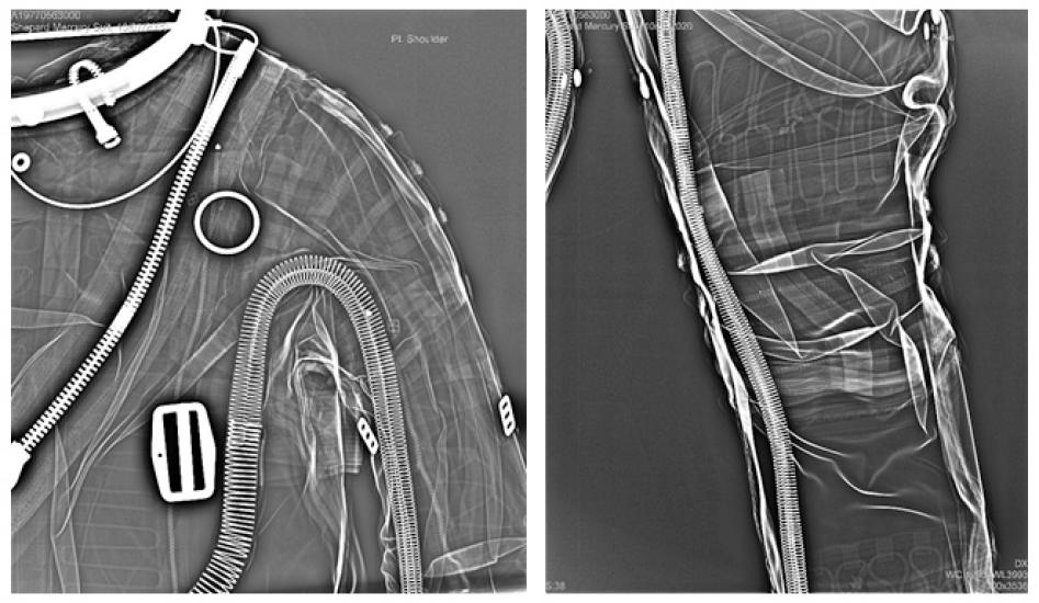 A side by side image of the shoulder region and arm region of a space suit.