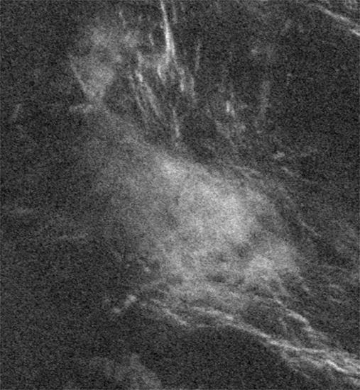 Black and white radar image of Venus surface. 