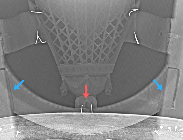 X-radiograph of lower splat showing dowel construction and modern wire repair nails